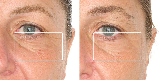 Before and after results of red LED light